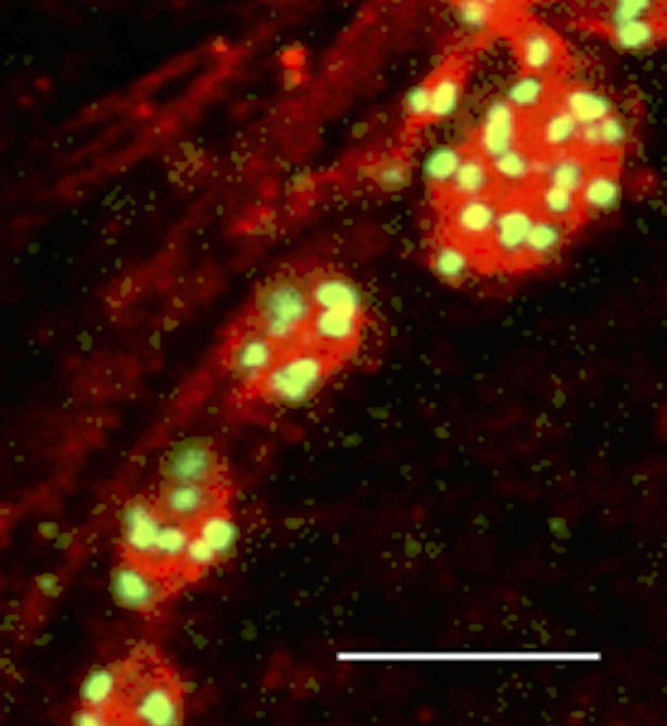 Botones axonales (en rojo) con las sinapsis (en amarillo) 