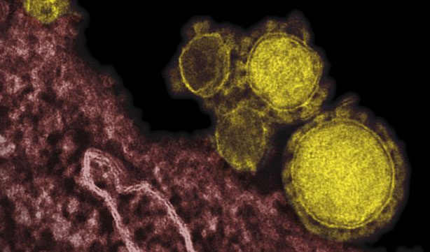 Imagen microscópica de coronavirus.