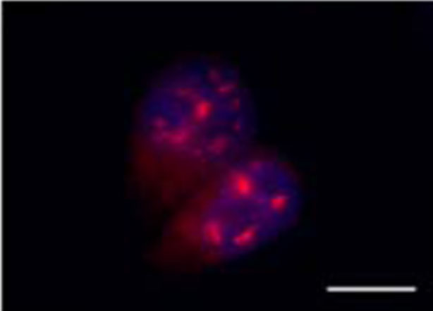 Células de cáncer de colon donde el ARN ultraconservado identificado aparece en color rojo. 