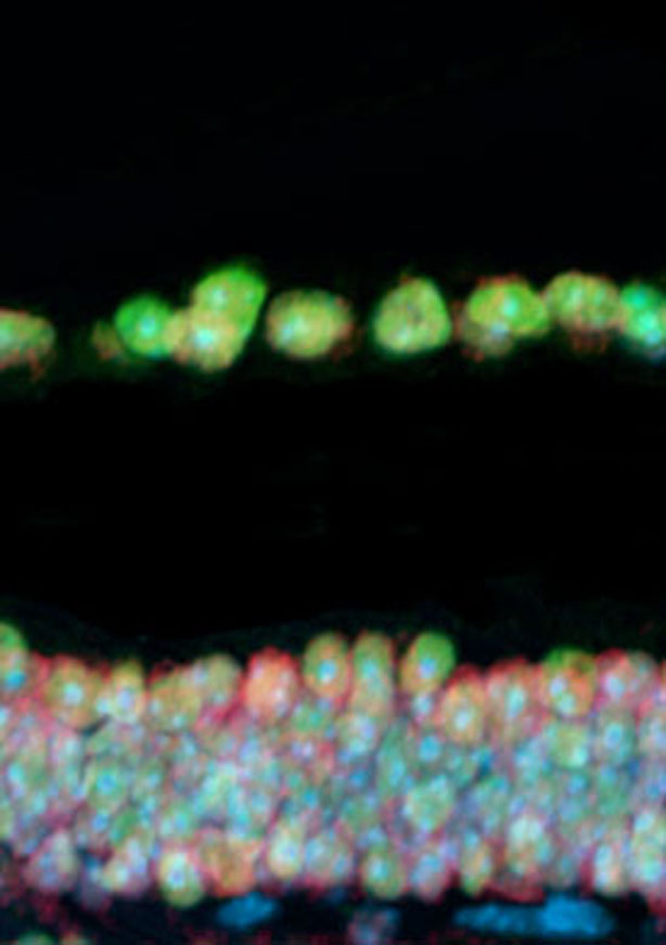 Corte de retina de un ratón sano 