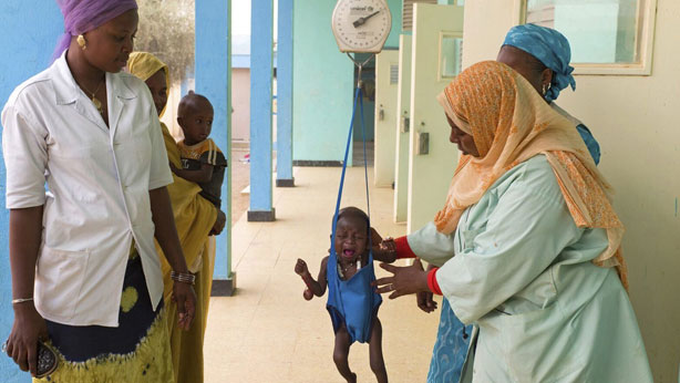 Toma de medidas de un niño con desnutrición en un centro sanitario de Mauritania. 