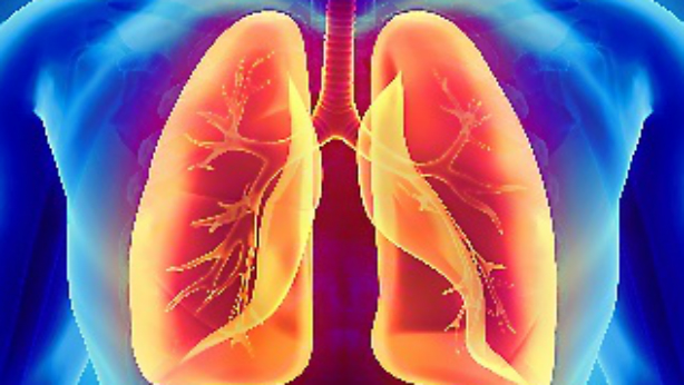 Cancer de pulmón 
