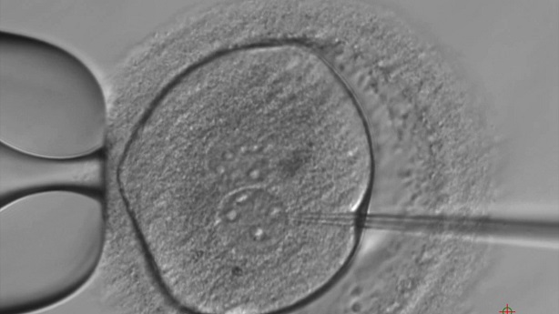 Microinyección en el embrión 