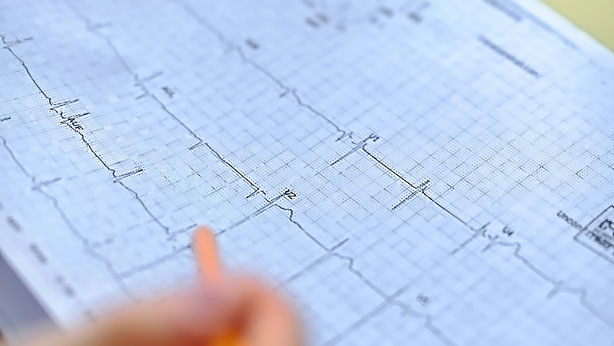 La startup Idoven trata de prevenir enfermedades cardiacas, redefiniendo la forma de diagnosticar las arritmias mediante inteligencia artificial y soluciones de salud digital. 