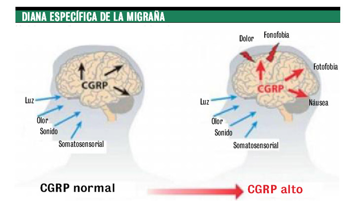 Modelo del CGPR en migraña. 