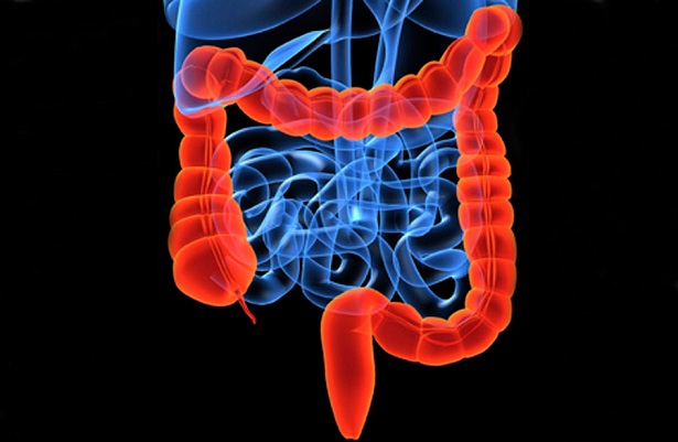 La colitis ulcerosa (CU) y la enfermedad de Crohn (EC) son las principales formas de enfermedad inflamatoria intestinal (EII). 