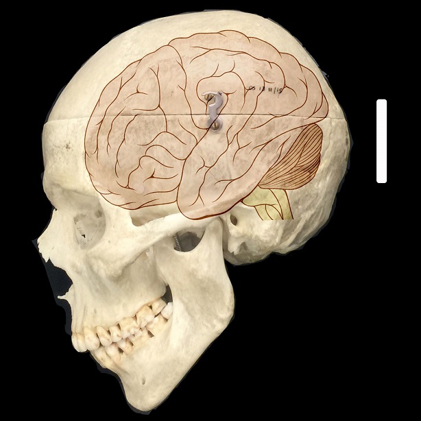 Cráneo y cerebro 