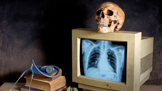 obsolescencia, tecnologia sanitaria,radiologia, radiografía 