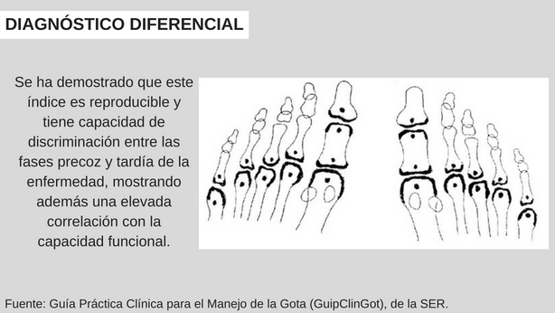 Diagnóstico diferencial 
