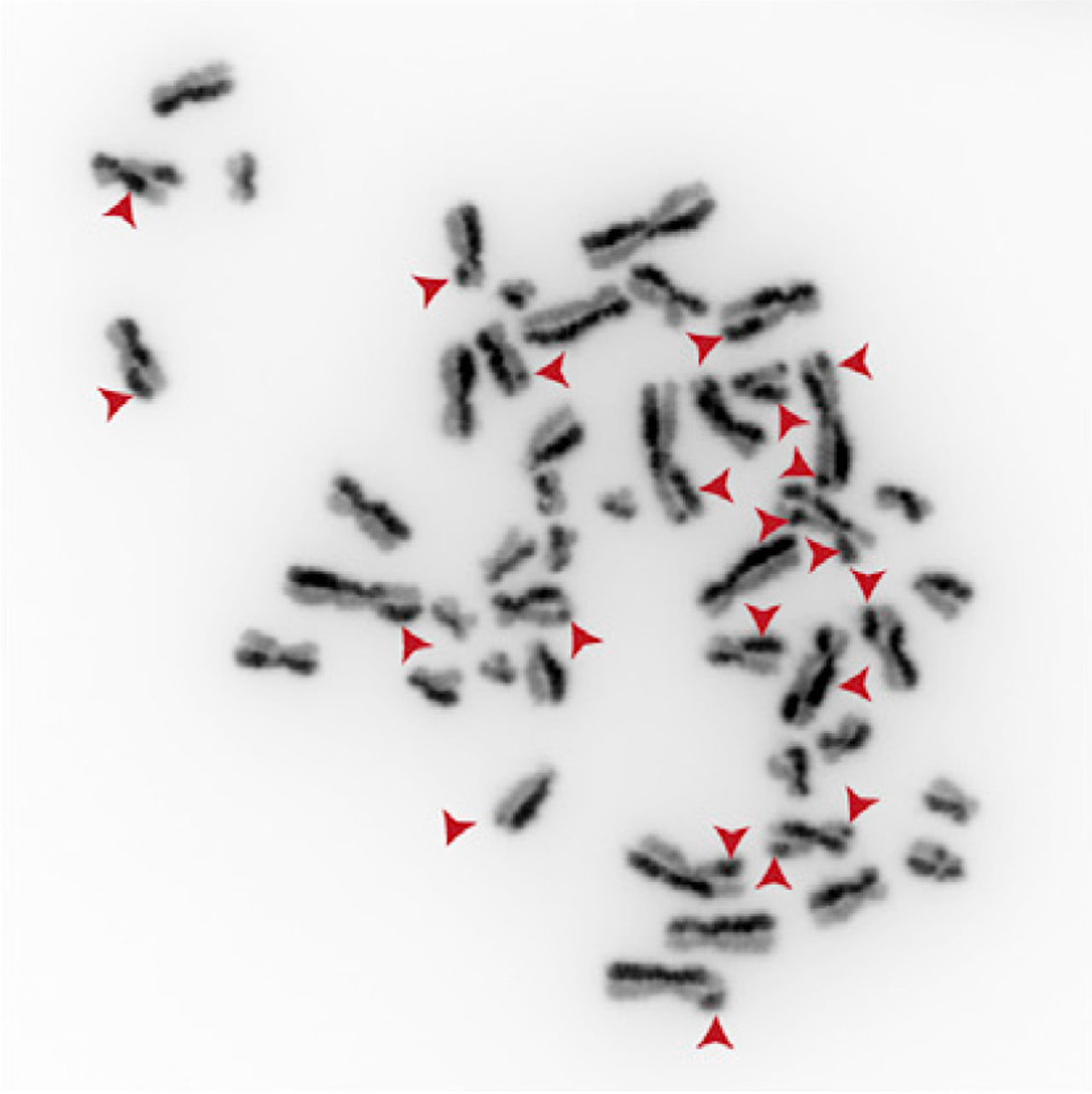Cromosomas de células con mutaciones en el gen TOP3A que presentan numerosos intercambios SCE (Sister chromatid exchange). 