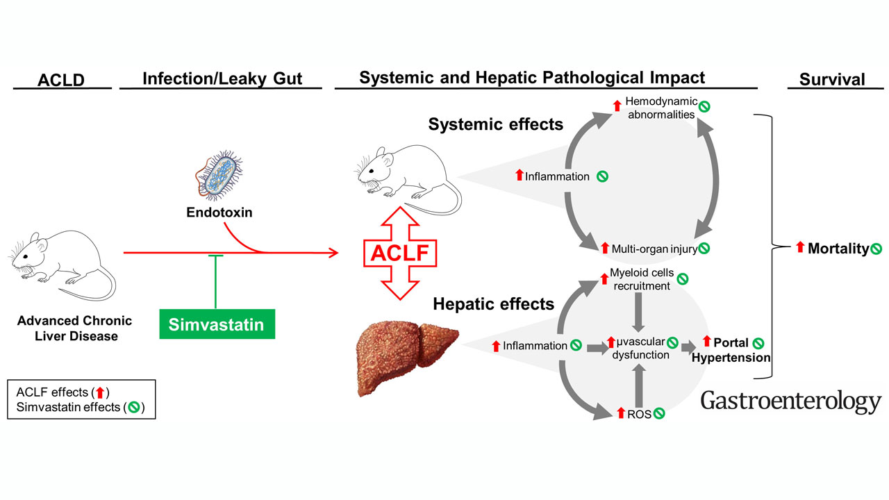 Resumen grÃ¡fico del estudio, fisiopatologÃa del ACLF y efectos protectores de simvastatina