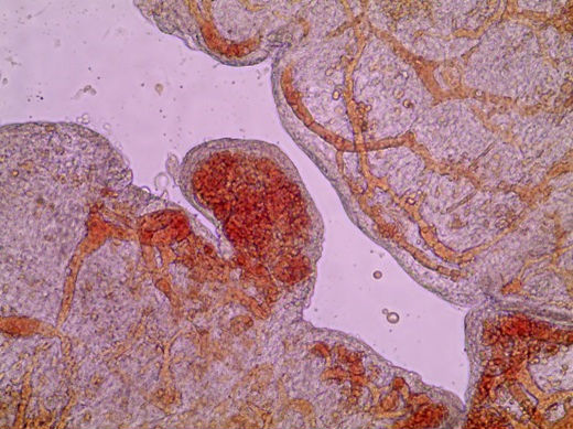 celulas-placenta 