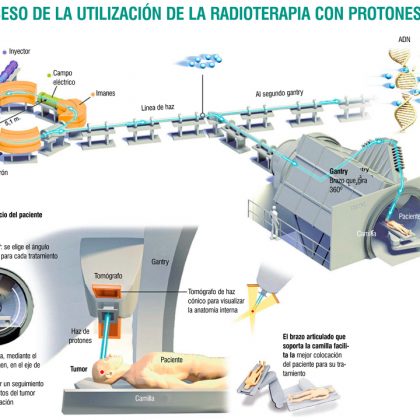 terapia de protones para el cáncer de cáncer de próstata metastásico