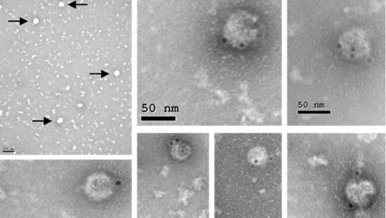 Detección mediante microscopía electrónica de partículas virales semejantes al virus del Zika generadas por la vacuna MVA-ZIKV. 