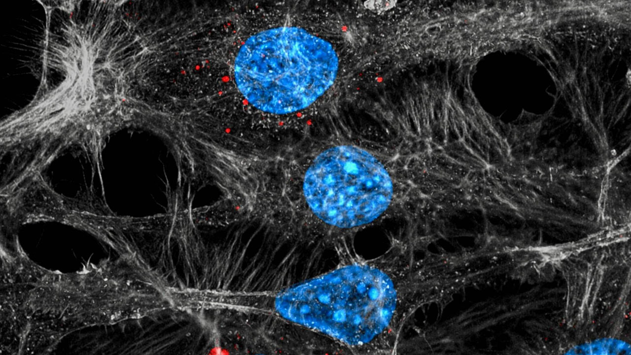 Las células endoteliales (azul/gris) interiorizan los exosomas (rojos) liberados por los tumores tratados por quimioterapia. 