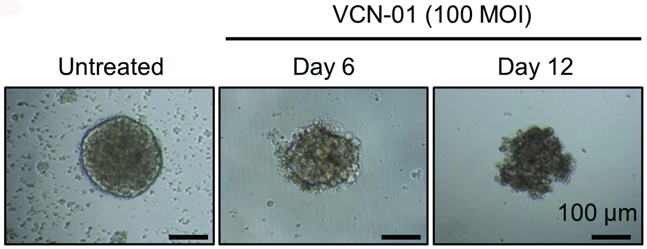 El VCN-01 empezó a dañar a las células del retinoblastoma a los doce días.