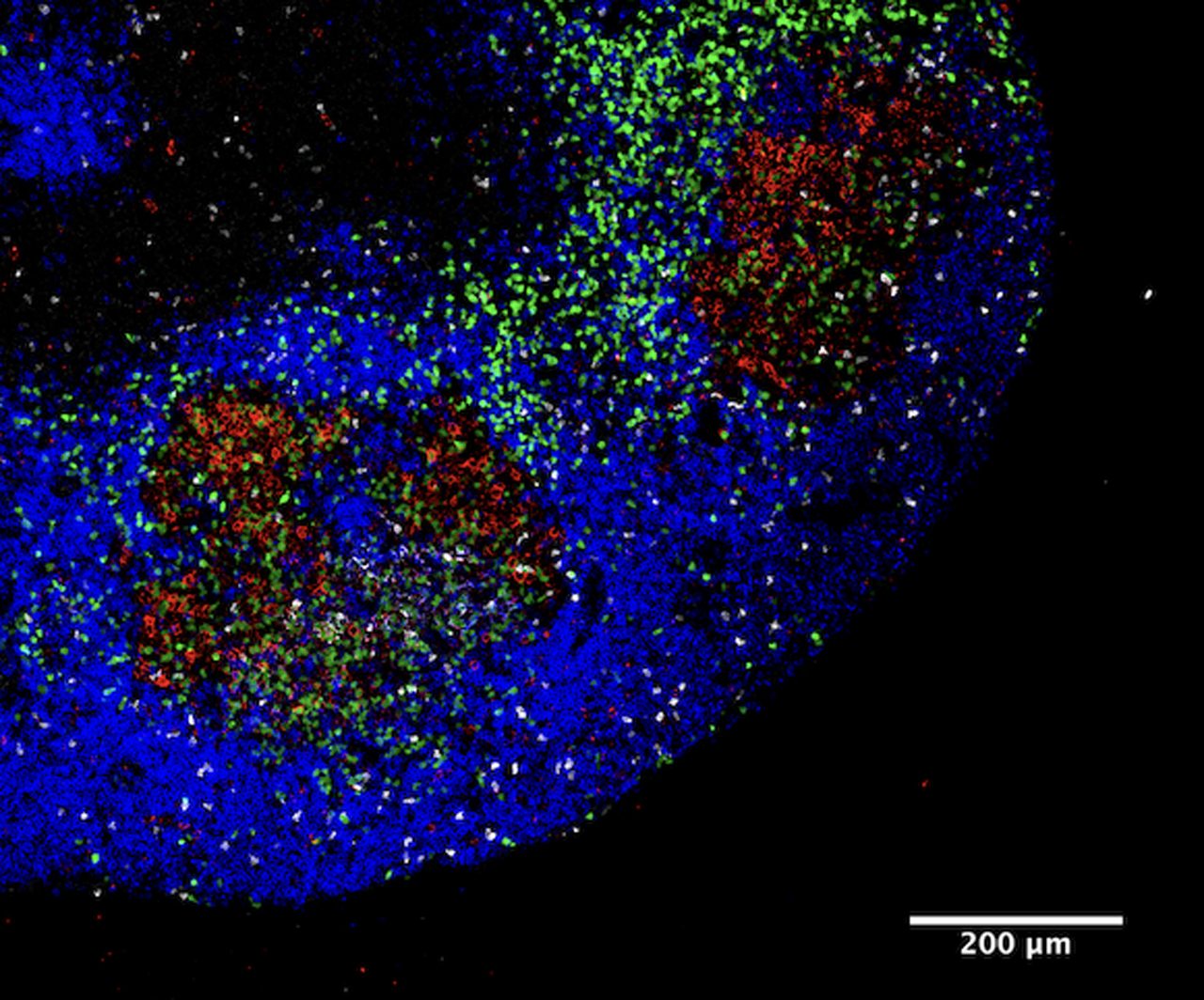 Linfocitos B (azul) se alían con los linfocitos T colaboradores (blanco) en el centro germinativo (rojo) de las amígdalas.