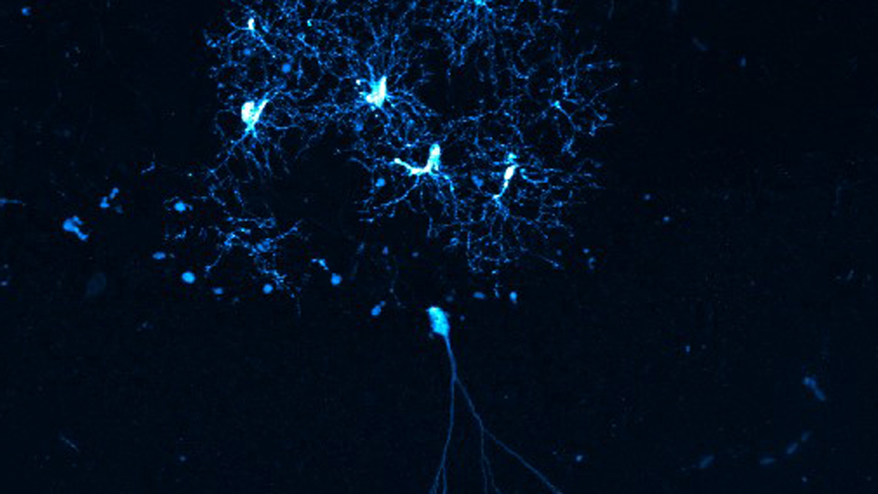 Neurona sobre células de microglía en hipocampo de ratón