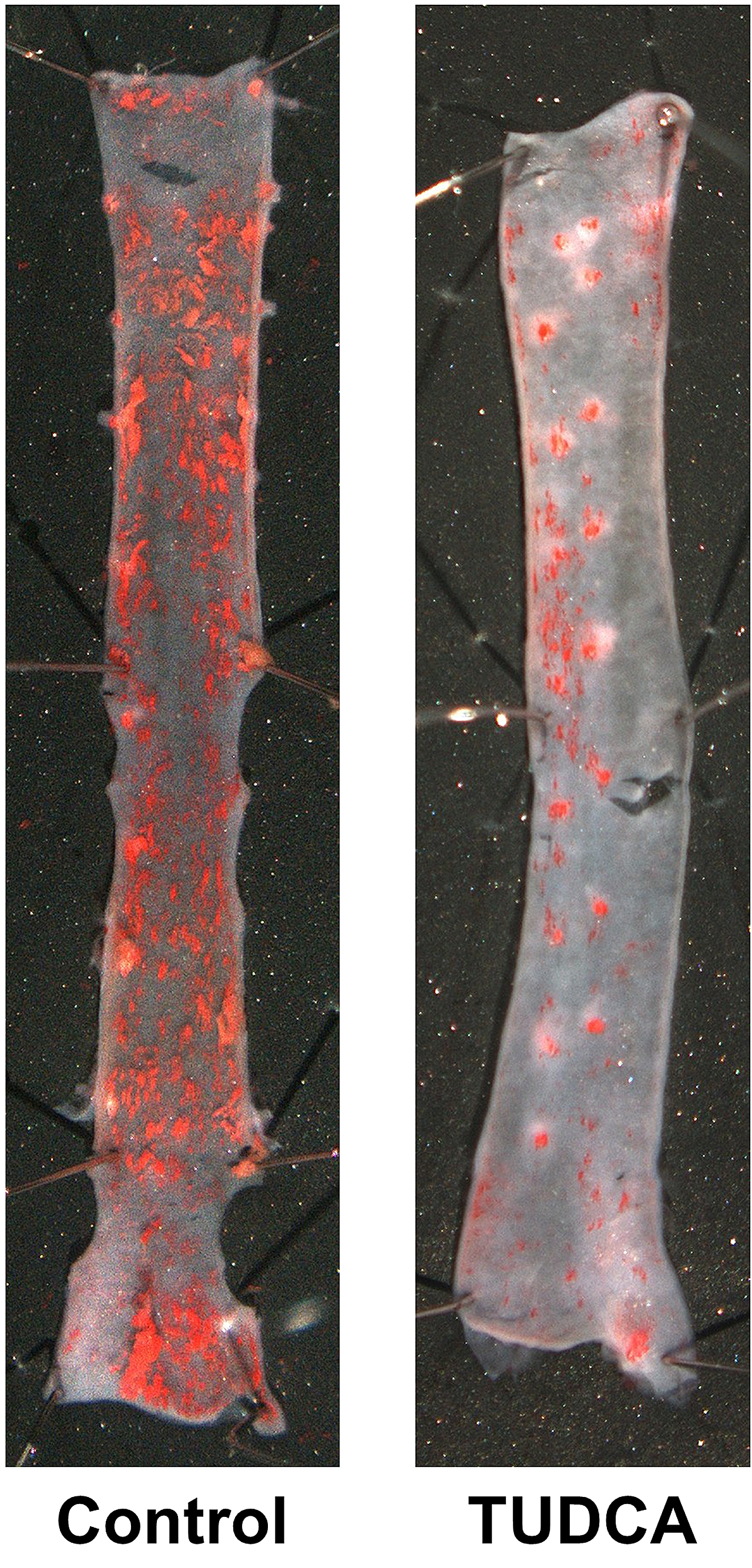 Administración de Tucda a ratones progéricos ralentiza la progresión de aterosclerosis.