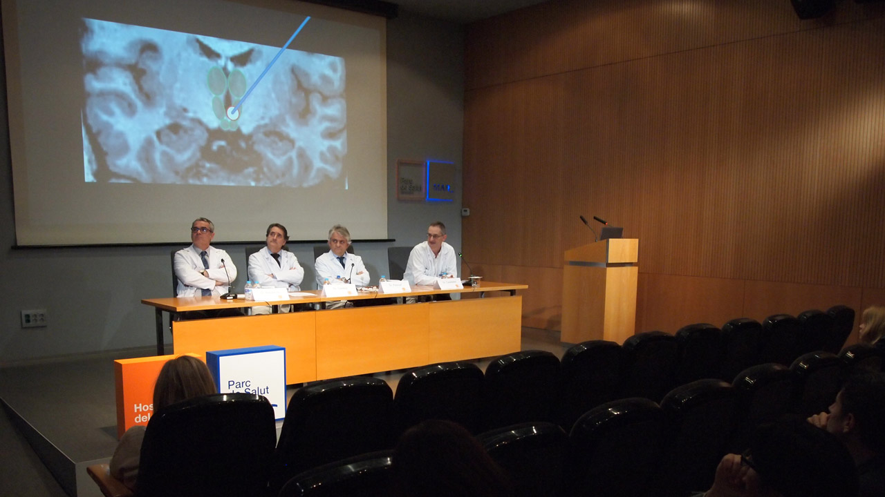 Rodrigo Rocamora, jefe de la Unidad de Epilepsia del Hospital del Mar; Gerardo Conesa, jefe del Servicio Mancomunado de NeurocirugÃa del Hospital del Mar y el Hospital de San Pablo; Julio Pascual, director mÃ©dico del Hospital del Mar; y Jaume Capellades, jefe de laq Unidad de NeurorradiologÃa del Hospital del Mar.