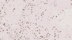 H�gado en plena proliferación (núcleos teñidos de marrón) tras una hepatectom�a parcial.