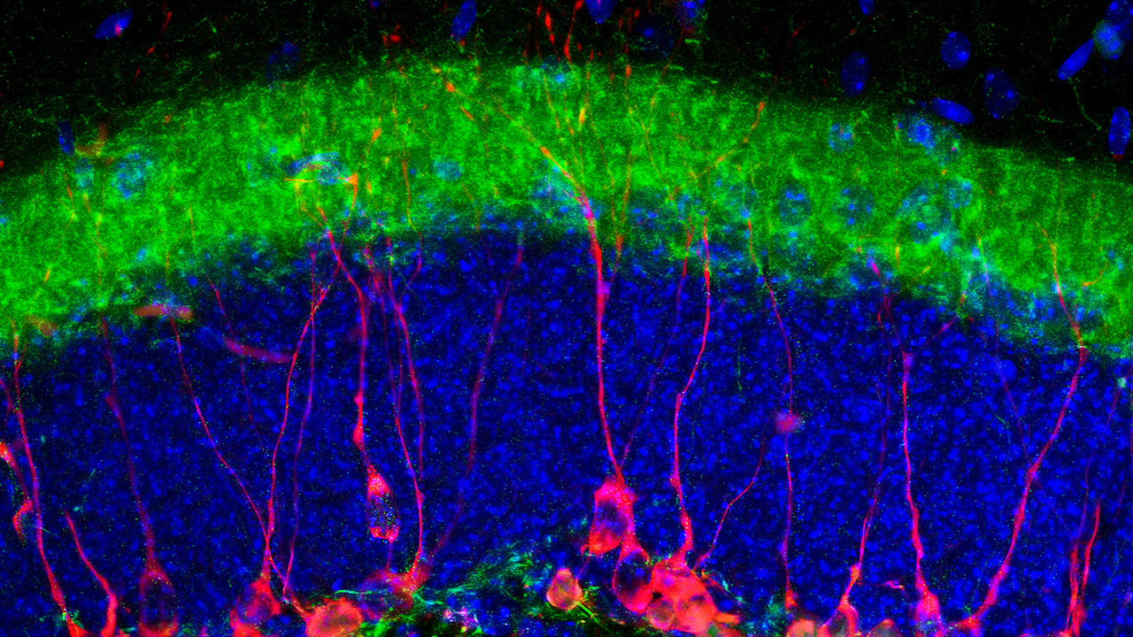 Marcadores de neuronas inmaduras.