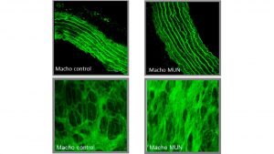 Imágenes de aorta de rata obtenidas mediante un microscopio confocal de fluorescencia. Imágenes superiores: pared de la arteria aorta. Imágenes inferiores: reconstrucciones tridimensionales de fibras de elastina.