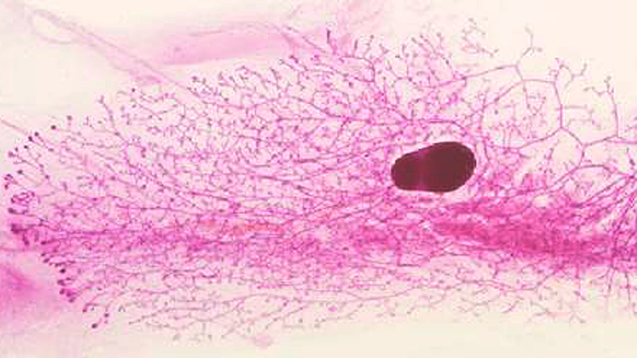 La pérdida de Sfrp3 estromal afecta la ramificación, la estructura ductal y la diferenciación del epitelio de la mama, lo que aumenta la predisposición al desarrollo de tumores en este tejido. 