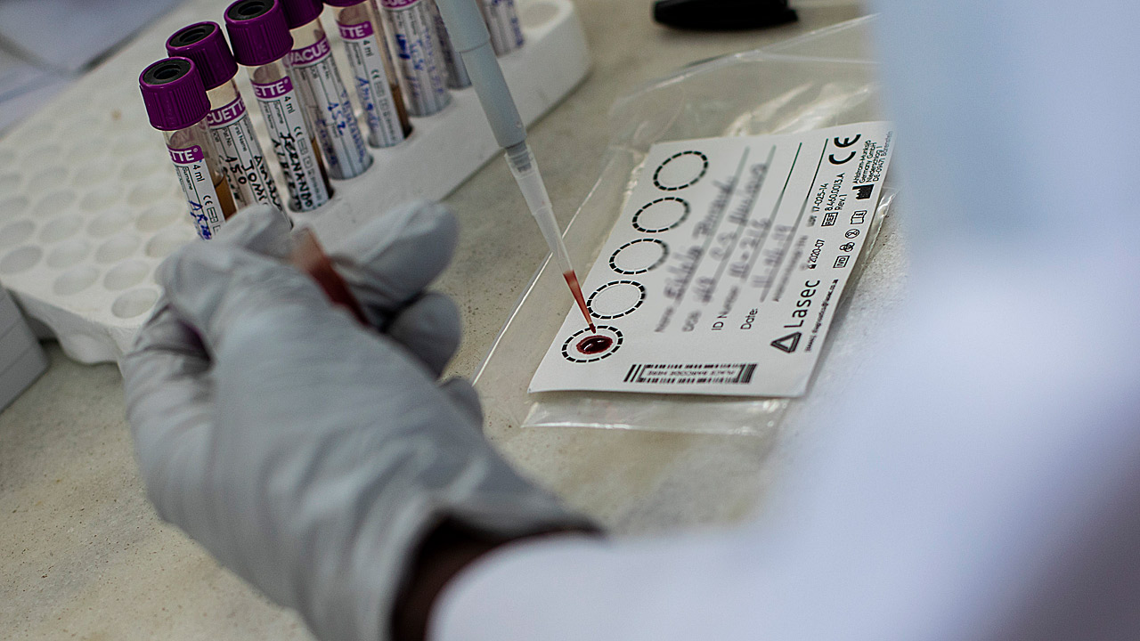 Un técnico de laboratorio de MSF analiza la carga viral de VIH de un paciente en Mozambique. 