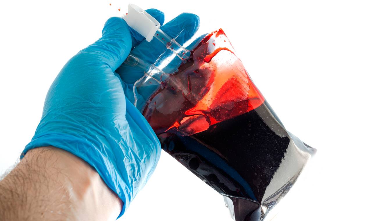 Imagen de una mano sujetando un plasma sanguíneo 
