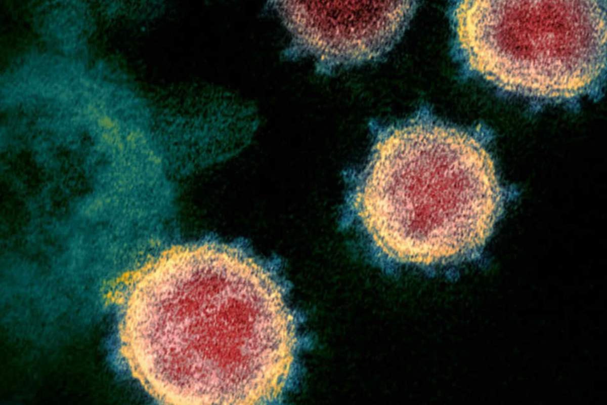 Imagen obtenida por microscopio electrónica del SARS-Cov-2, el virus causante del Covid-19, aislado de un paciente en Estados Unidos. 