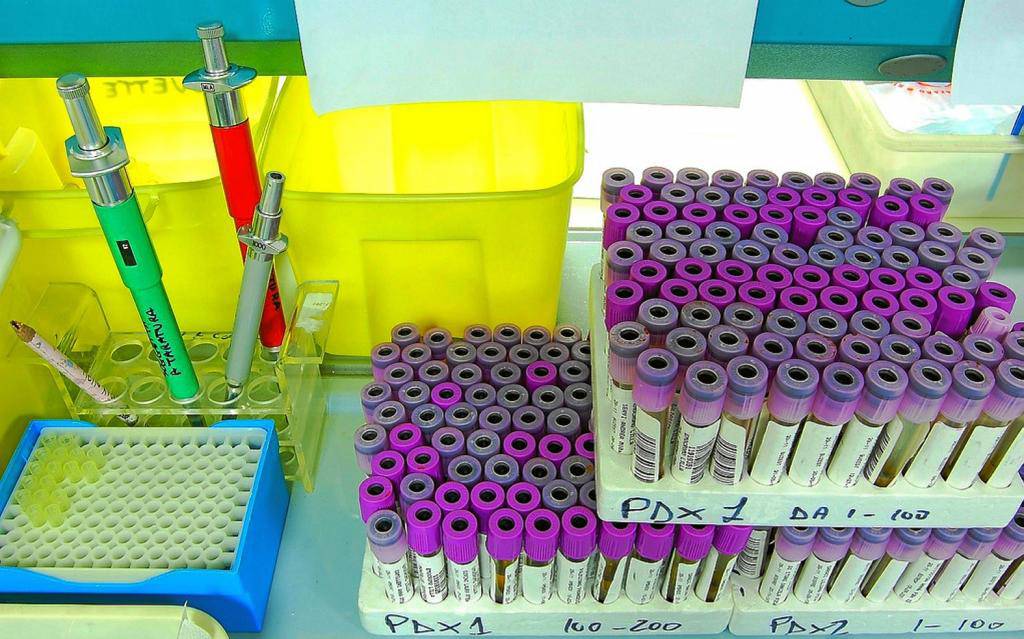 Tubos con muestras de sangre preparados para analizar 