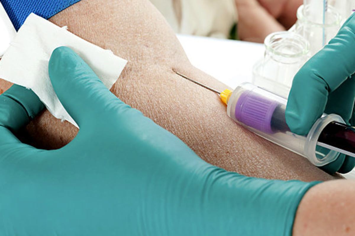 Investigadores han desarrollado un test que detecta en una muestra de sangre si una persona está o no libre de cáncer. 