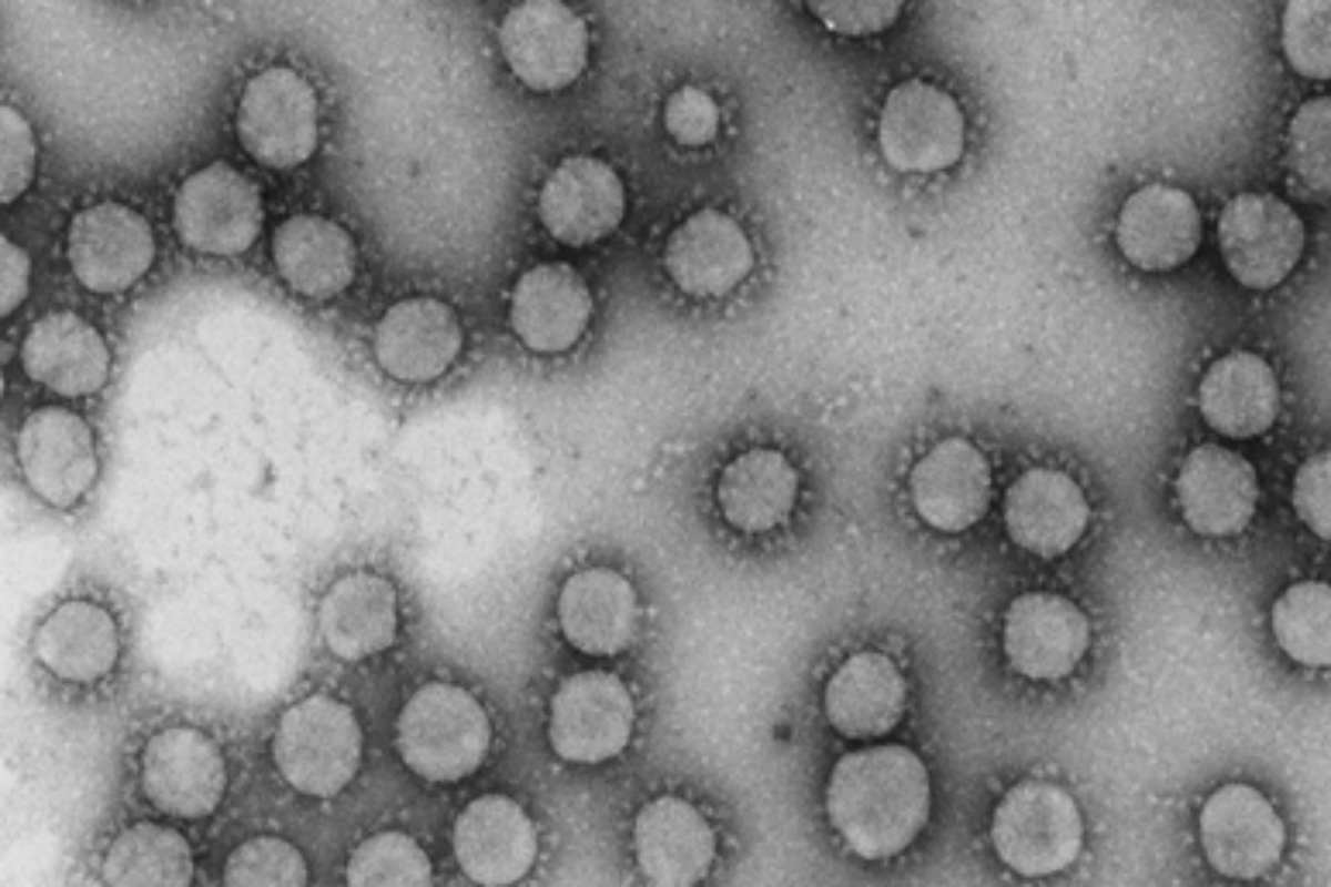 Virus de la familia coronaviridae 