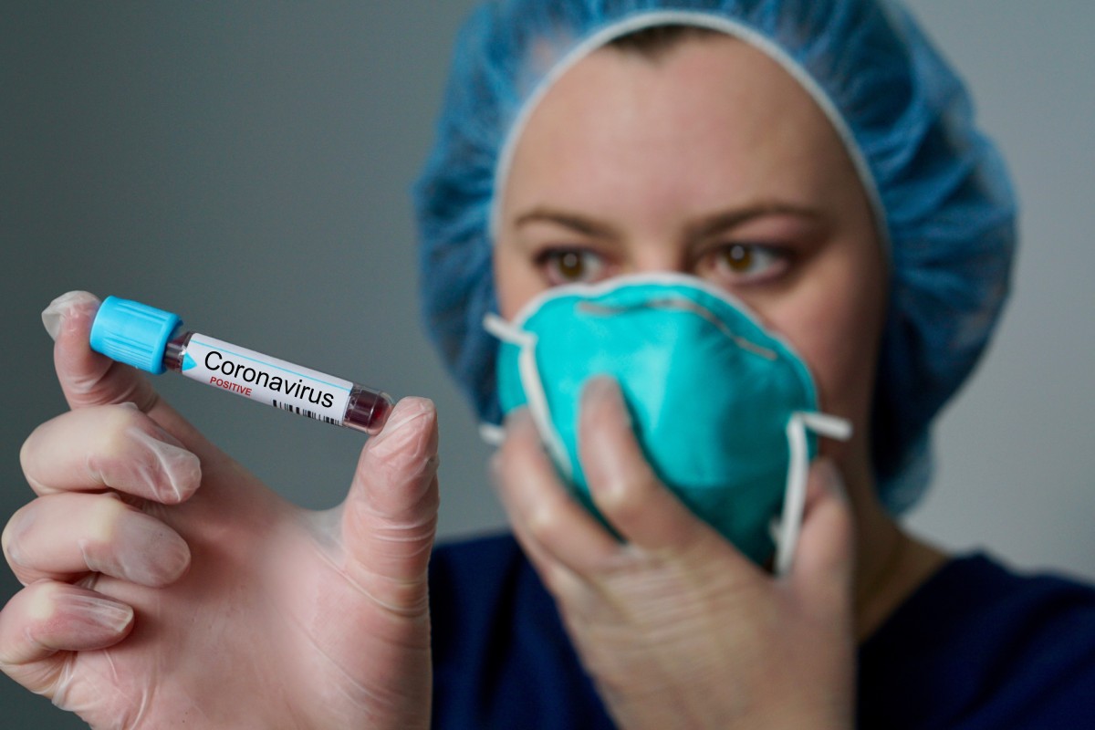 Son necesarios más test para conocer los casos de coronavirus 