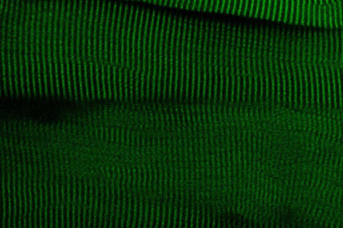 Tejido muscular de ratón modificado con el módulo fluorescente HaloTag-TEV