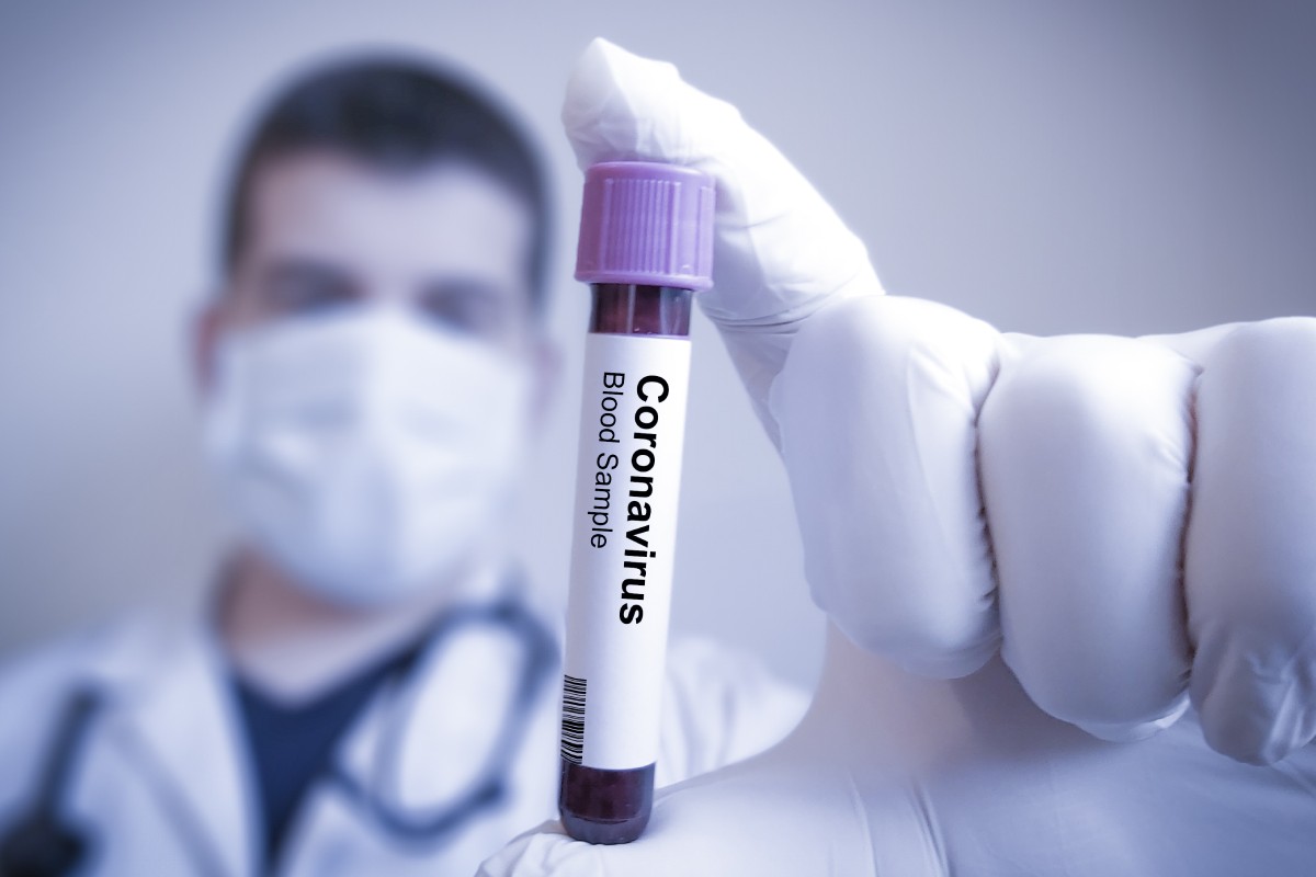 Sanitario y test de coronavirus 