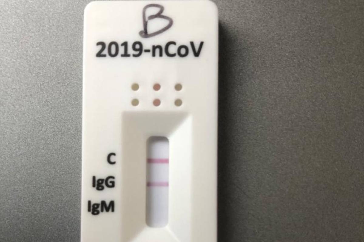 Un ejemplo de test Covid-19, con las inmunoglobinas IgG e IgM.