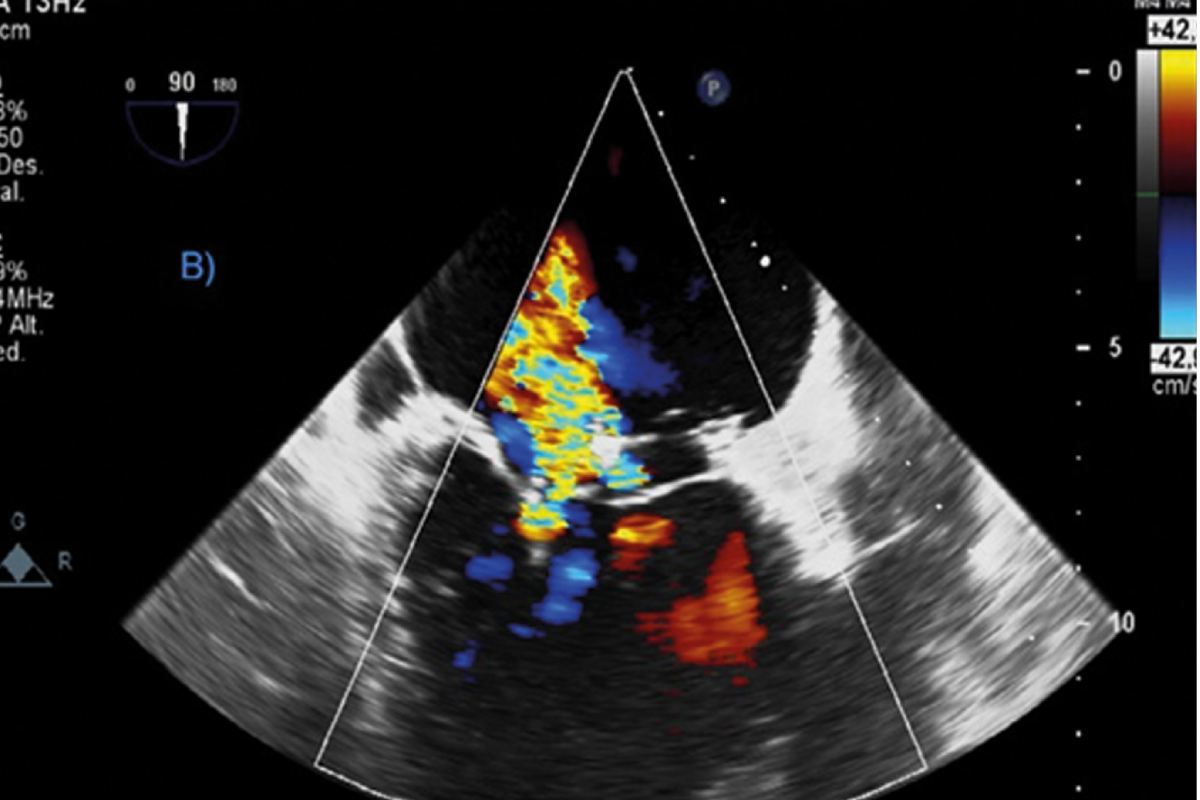 Imagen de un estudio ecocardiográfico. 