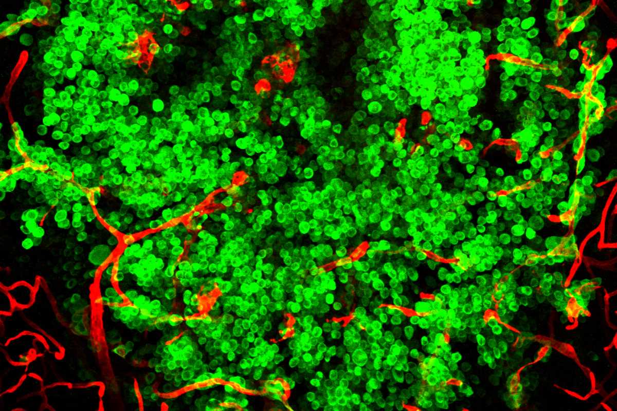 Células tumorales (verde) invaden un cerebro de ratón (rojo).