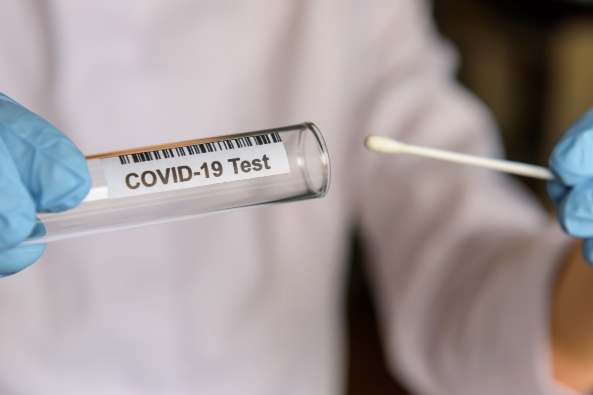 Test de coronavirus 