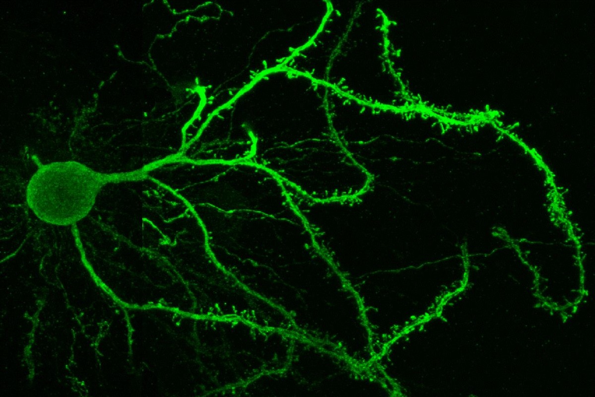 Imagen de una neurona estriatal de la vía directa que muestra la riqueza del árbol dendrítico y la densidad de las espinas dendríticas por donde se comunica con otras neuronas de la sustancia negra. (CSIC) 