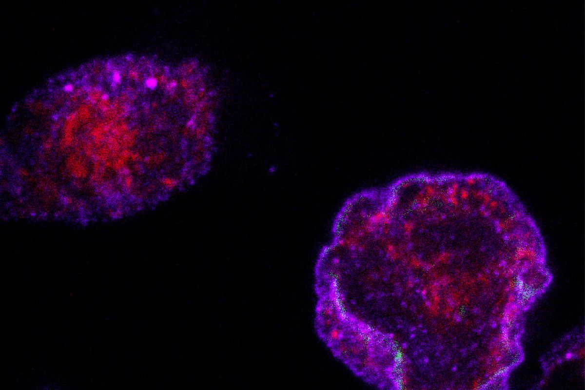 Células musculares en cultivo normales (izquierda) y con Vav2 hiperactivado (derecha) mostrando en azul la cantidad de proteína de captación de glucosa presente en la membrana. FOTO: CICS.