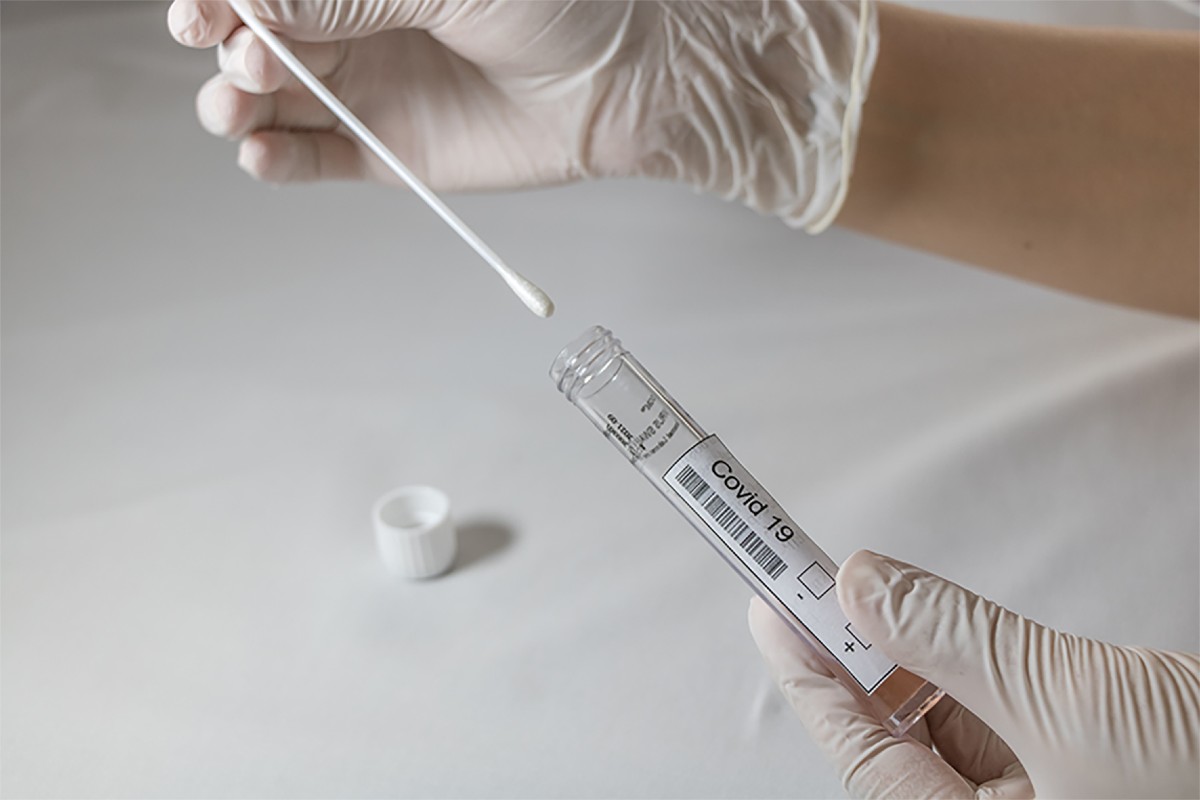 Test PCR para detección de SARS-CoV-2