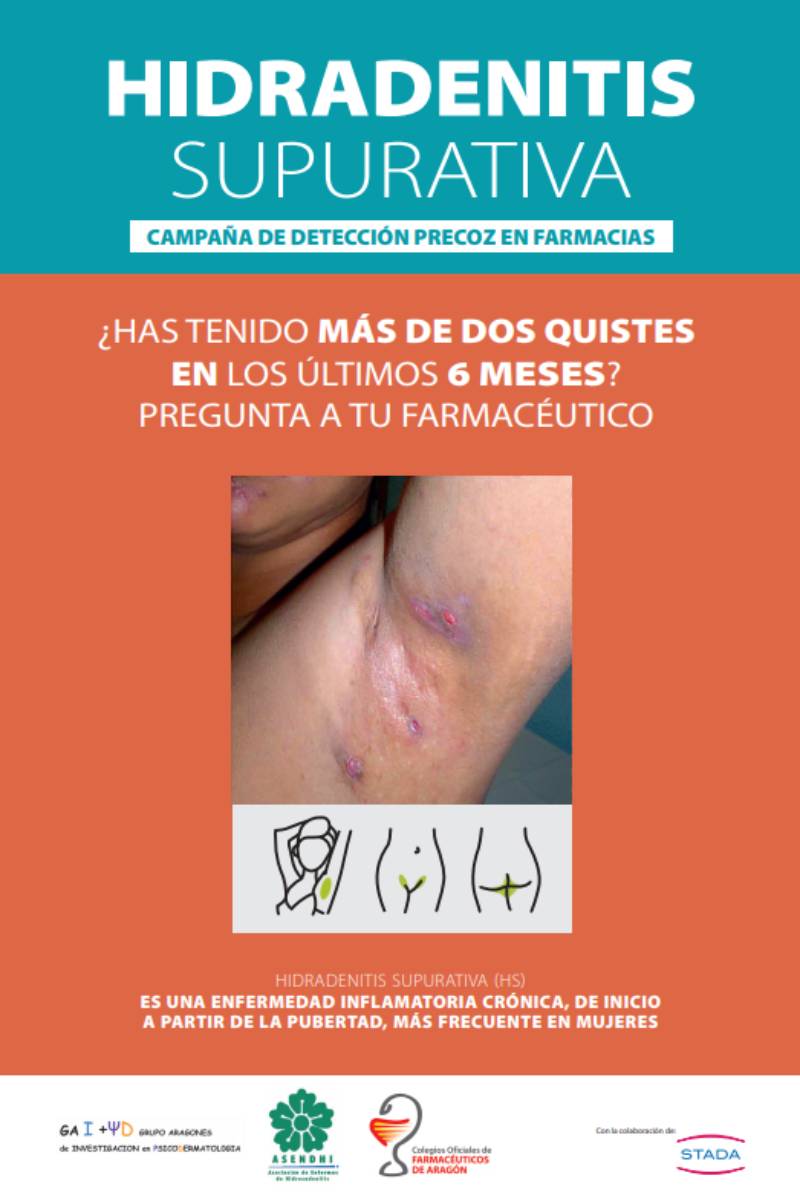 Cartel de la campaña sobre hidrosadenitis supurativa.