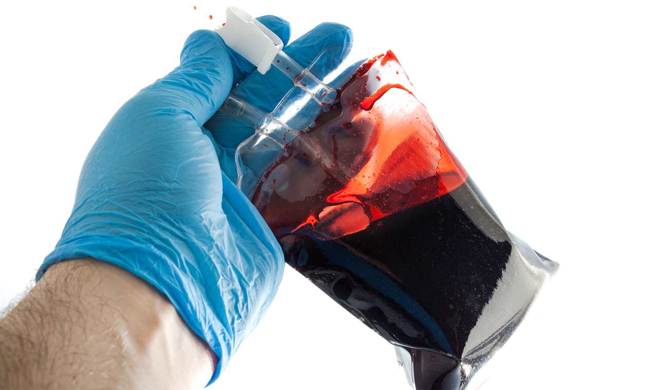 diabetes investigación con células madre 2020