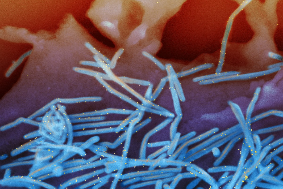 Micrografía electrónica de barrido de viriones del virus respiratorio sincitial humano.