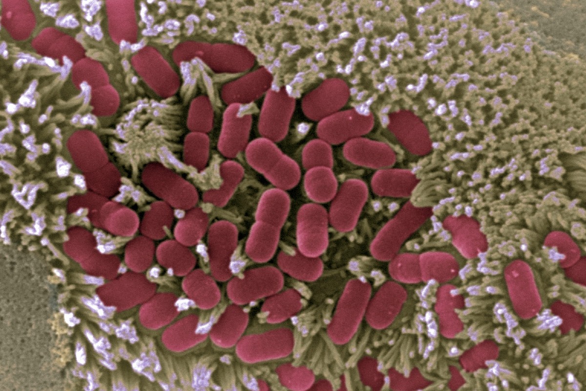 Imagen microscópica de la mucosa intestinal afectada por 'E. coli' (CNB-CSIC). 
