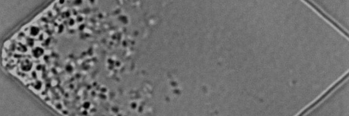 La célula sintética JCVI-syn3A se divide, imagen de microscopio.