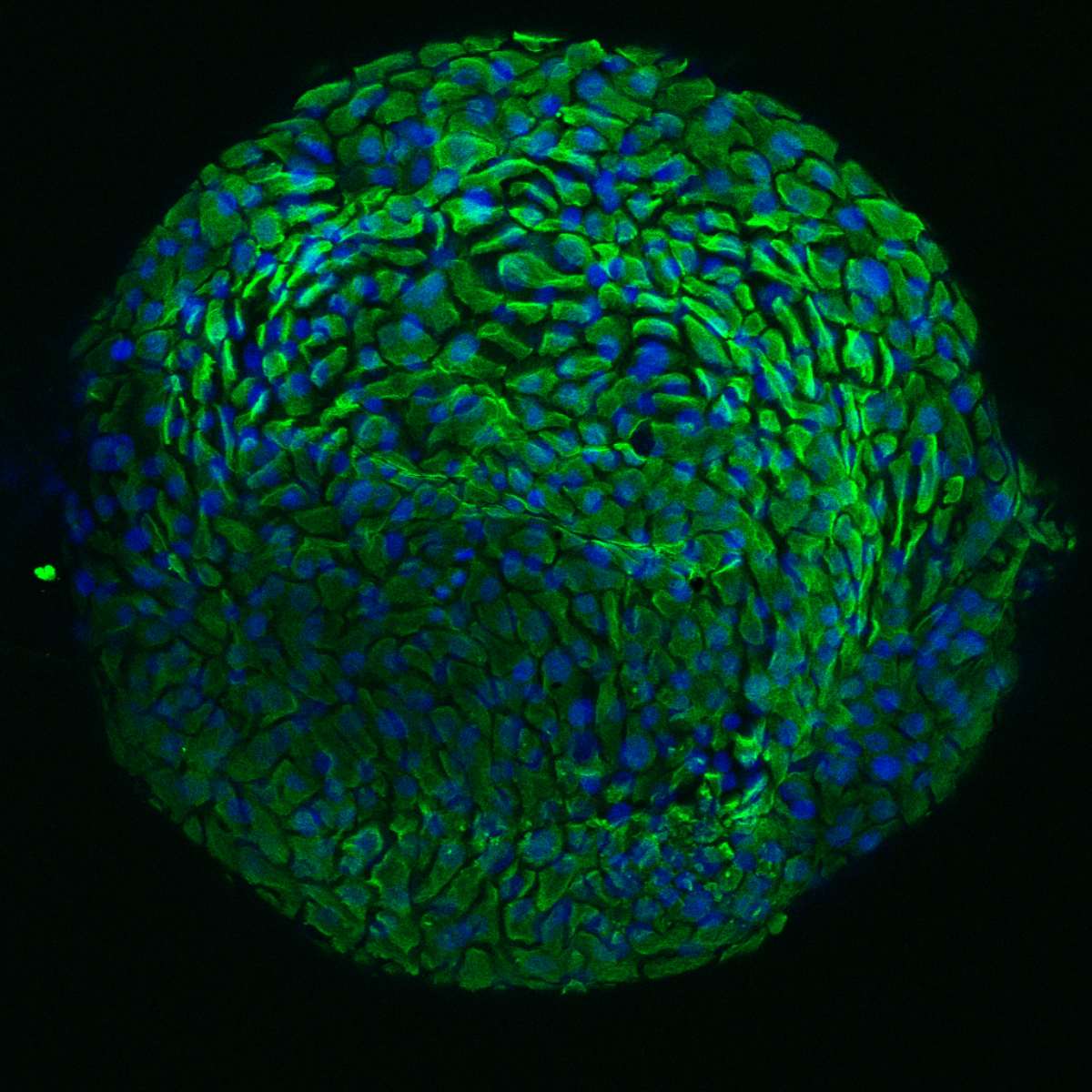 Célula de organoide de cuello de útero.